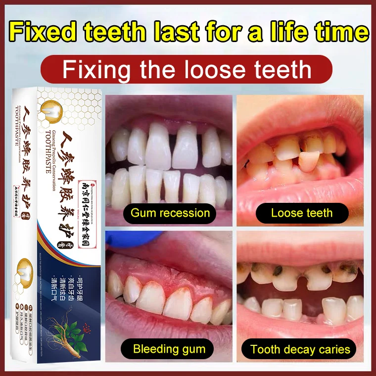 Loose Teeth Care Toothpaste