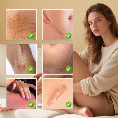 Professional Scar Removal Gel