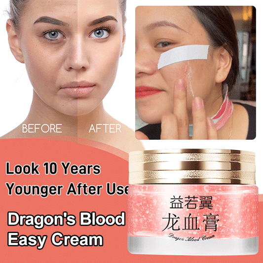 🔥BUY 3 GET 2 FREE🔥DRAGONS BLOOD EASY CREAM