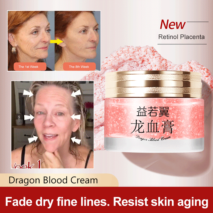 🔥BUY 3 GET 2 FREE🔥DRAGONS BLOOD EASY CREAM