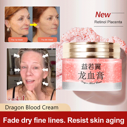 🔥BUY 3 GET 2 FREE🔥DRAGONS BLOOD EASY CREAM