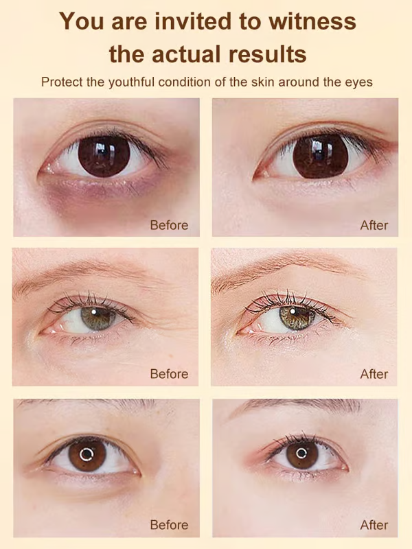 ✨Buy 1 get 1 Free✨ Dinkiss Lutein Eye Essence Oil