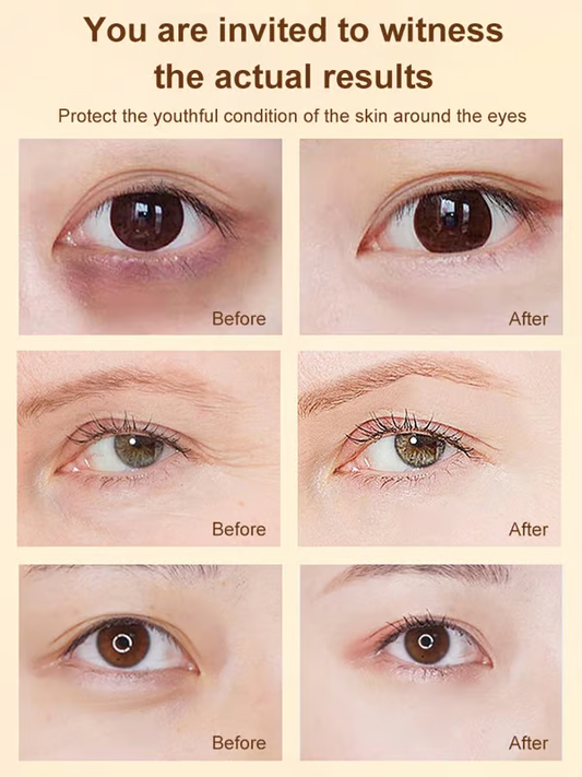 ✨Buy 1 get 1 Free✨ Dinkiss Lutein Eye Essence Oil