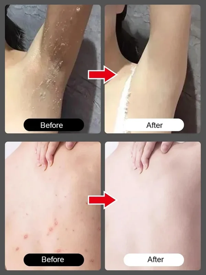 Body Exfoliating Nicotinamide Gel