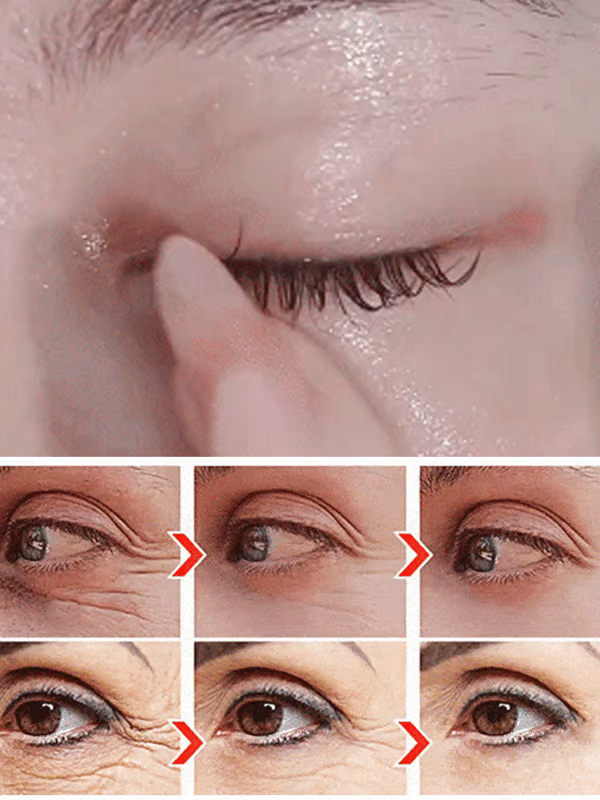 ✨Buy 1 get 1 Free✨ Dinkiss Lutein Eye Essence Oil