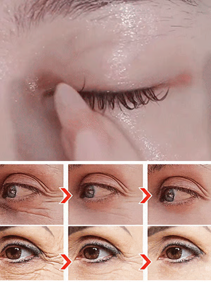 ✨Buy 1 get 1 Free✨ Dinkiss Lutein Eye Essence Oil