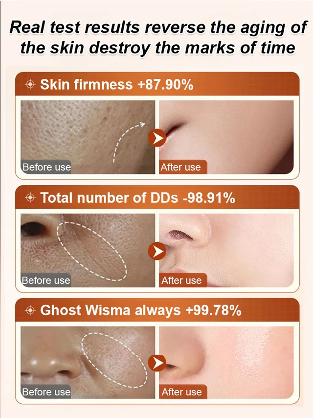 🔥BUY 1 GET 1 FREE🔥Ecdoin anti aging essence