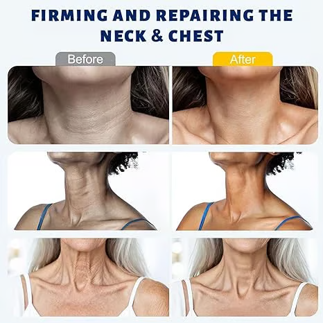 Reduces Wrinkles and Double Chin,Five Rollers for All Around Massage,Neck Firming Cream