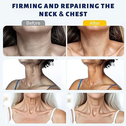 Reduces Wrinkles and Double Chin,Five Rollers for All Around Massage,Neck Firming Cream