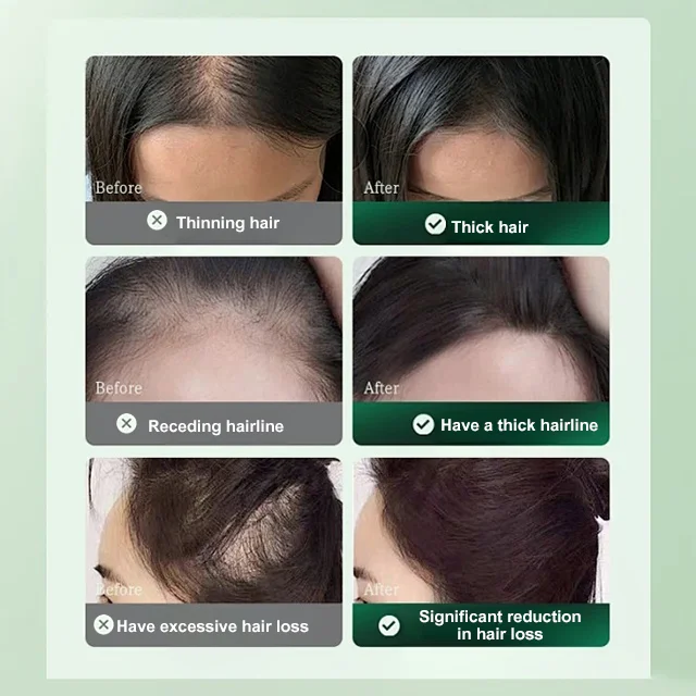 Anti-Hair Loss and Hair Growth Solution