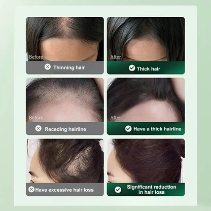 Anti-Hair Loss and Hair Growth Solution