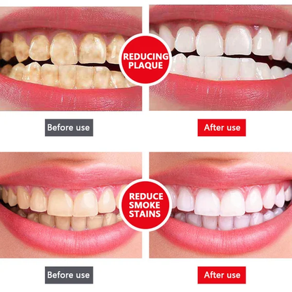 All Smiles Brightening Stain Removing Probiotic Toothpaste