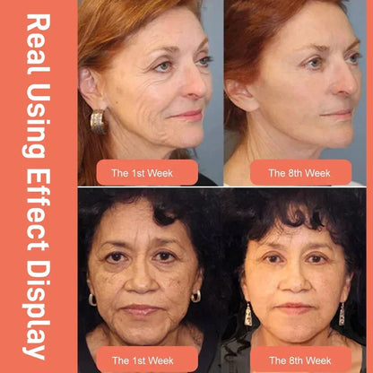 🔥BUY 3 GET 2 FREE🔥DRAGONS BLOOD EASY CREAM