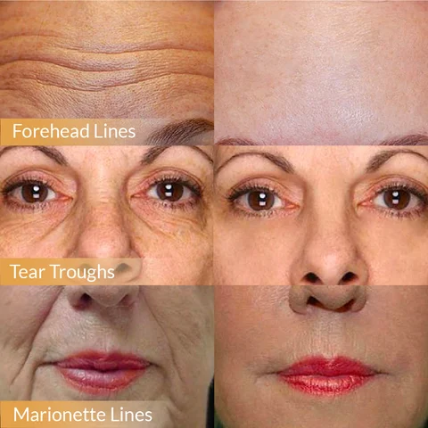 🔥 Buy 1 Get 1 Free🔥2026 Hot Sale Polypeptide Firming Full Face Cream